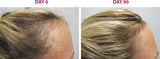 Hair Growth