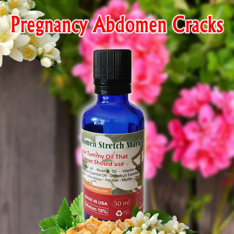 Pregnancy Abdomen Cracks